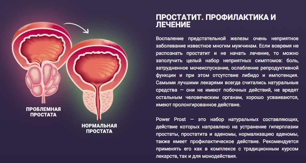 Простатит у мужчин. Воспаление в предстательной железе.